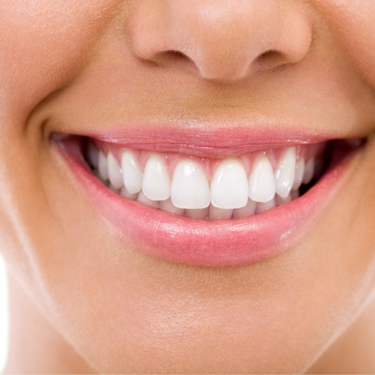 Come rimuovere la placca dentale sui denti – cos’è e come si forma? – artDENTAL